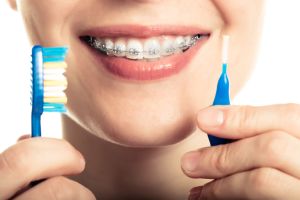 How to Care for Your Braces Over the Holiday Break