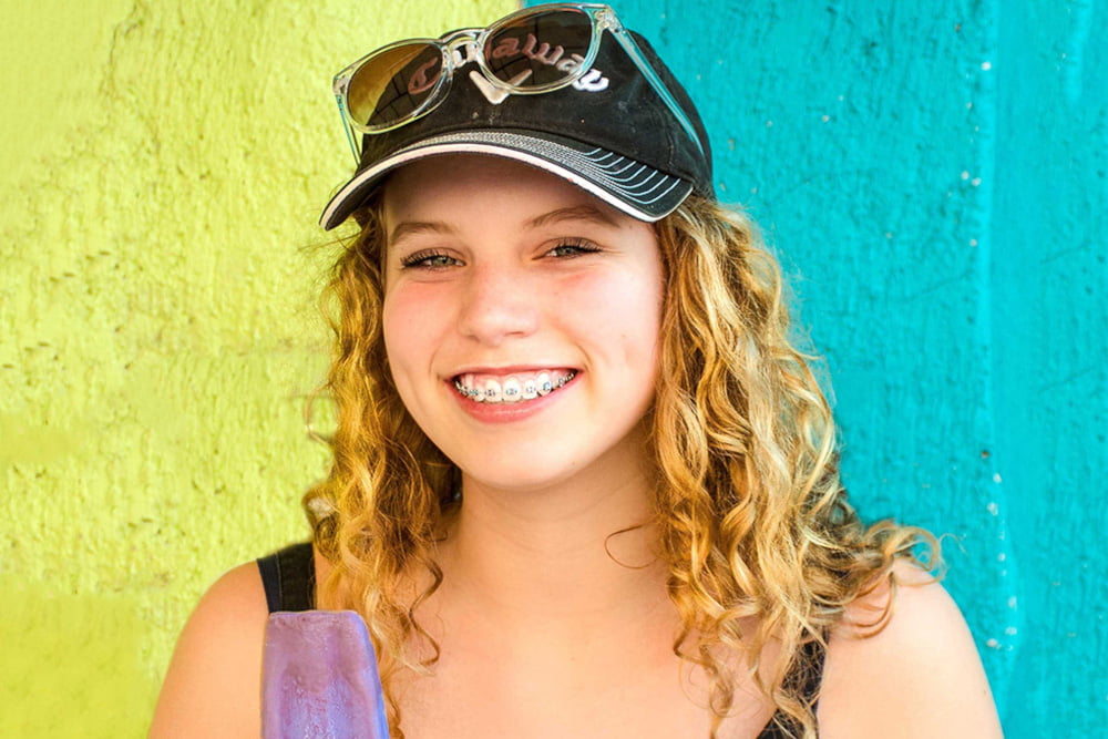 Six Hidden Benefits of Braces